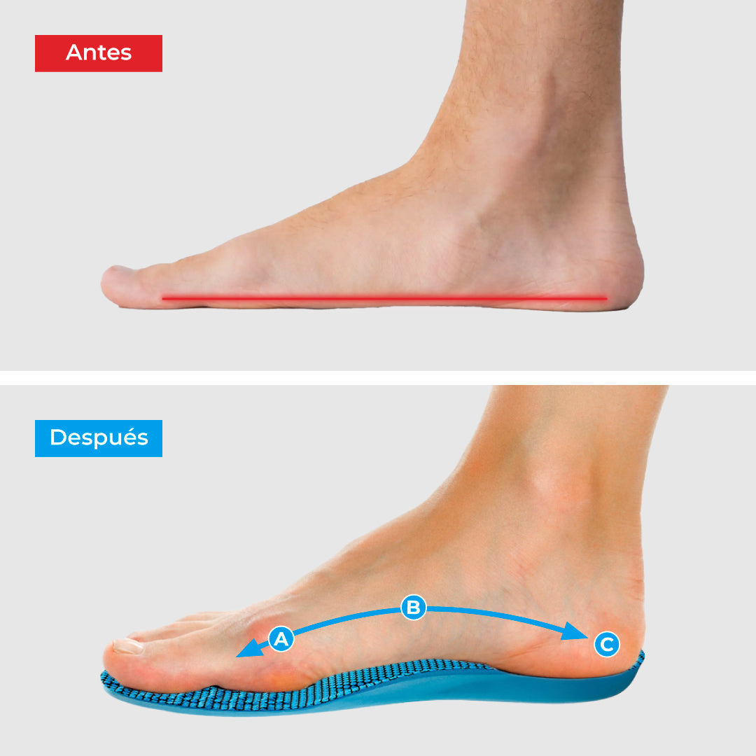 Plantillas ComfyFeet™️ - Disfruta de días sin dolor, sin tratamientos caros ni visitas al médico....