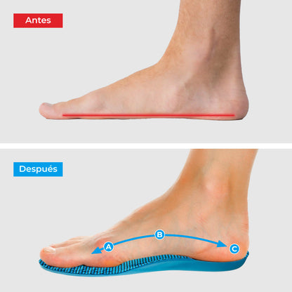 Plantillas ComfyFeet™️ - Disfruta de días sin dolor, sin tratamientos caros ni visitas al médico....